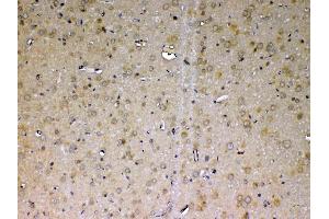 IHC analysis of ADA using anti-ADA antibody . (ADA anticorps  (AA 2-238))