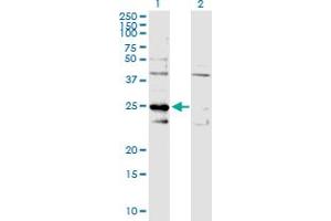 Lane 1: C1QBP transfected lysate ( 31. (C1QBP 293T Cell Transient Overexpression Lysate(Denatured))