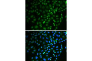 Immunofluorescence analysis of U2OS cells using TRIM21 antibody. (TRIM21 anticorps)