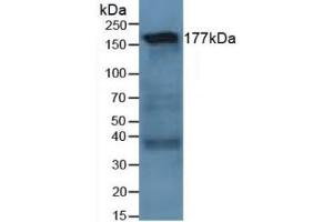 Detection of LAMC1 in Human Lung Tissue using Polyclonal Antibody to Laminin Gamma 1 (LAMC1) (Laminin gamma 1 anticorps  (AA 521-772))