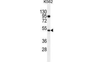 TdT Antibody (C-term) western blot analysis in K562 cell line lysates (35 µg/lane). (TdT anticorps  (C-Term))