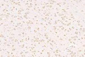 Immunohistochemistry analysis of paraffin-embedded mouse substantia nigra using VPS13B (ABIN7076176) at dilution of 1: 2000 (VPS13B anticorps)