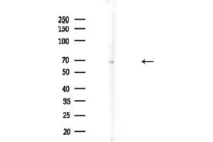 anti-LIM Domain Kinase 1 (LIMK1) (pThr508) antibody
