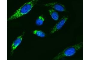 IF analysis of ATP5F1B using anti-ATP5F1B antibody (ABIN7599866). (Atp5f1b (AA 123-529) anticorps)