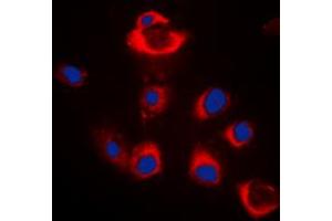 Immunofluorescent analysis of BAX staining in HeLa cells. (BAX anticorps  (Center))