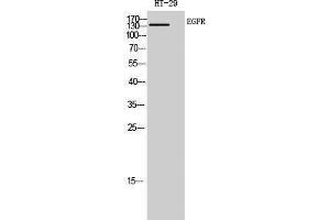 Western Blotting (WB) image for anti-Epidermal Growth Factor Receptor (EGFR) (Ser322), (Ser325) antibody (ABIN3180031) (EGFR anticorps  (Ser322, Ser325))