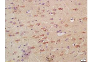 Formalin-fixed and paraffin embedded rat brain labeled with Anti-MPO Polyclonal Antibody, Unconjugated (ABIN1387491) at 1:200, followed by conjugation to the secondary antibody and DAB staining (Myeloperoxidase anticorps  (AA 678-745))