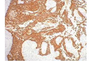 Immunohistochemistry (IHC) image for anti-Keratin 16 (KRT16) antibody (ABIN3178609) (KRT16 anticorps)