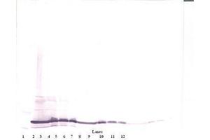 Image no. 2 for anti-Interleukin 17F (IL17F) antibody (ABIN465701) (IL17F anticorps)