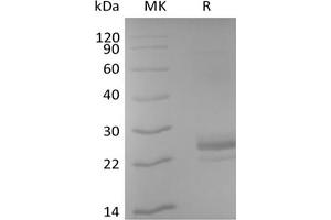 Western Blotting (WB) image for CD40 Ligand (CD40LG) protein (Biotin,His-Avi Tag) (ABIN7319900) (CD40 Ligand Protein (CD40LG) (Biotin,His-Avi Tag))