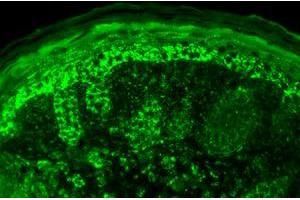 Cpn10 Immunofluorescence.