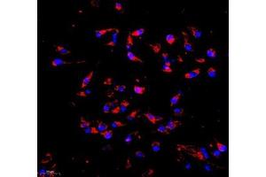 Immunocytochemistry analysis of 4 % paraformaldehyde-fixed HeLa cells using COX5B (ABIN7073665) at dilution of 1: 1000 (200x lens)