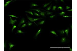 Immunofluorescence of purified MaxPab antibody to DUSP12 on HeLa cell.