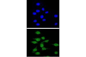 Confocal immunofluorescent analysis of AIRE Antibody (Center) (ABIN655031 and ABIN2844662) with 293 cell followed by Alexa Fluor® 488-conjugated goat anti-rabbit lgG (green). (AIRE anticorps  (AA 64-92))