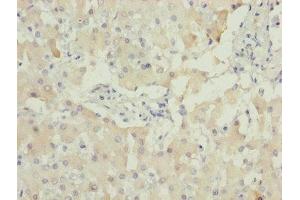 Immunohistochemistry of paraffin-embedded human liver tissue using ABIN7142330 at dilution of 1:100 (AKR1D1 anticorps  (AA 1-200))