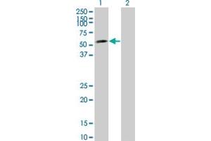 Western Blot analysis of LEF1 expression in transfected 293T cell line by LEF1 monoclonal antibody (M08), clone 2E2. (LEF1 anticorps  (AA 33-138))
