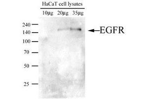 Image no. 1 for anti-Epidermal Growth Factor Receptor (EGFR) (AA 424-605) antibody (ABIN782452) (EGFR anticorps  (AA 424-605))