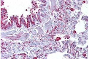 Anti-GABRB3 antibody IHC staining of human lung. (GABRB3 anticorps  (AA 180-229))