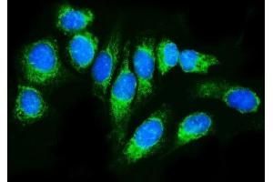 IF analysis of TRAP Alpha/TRAPA/SSR1 using anti-TRAP Alpha/TRAPA/SSR1 antibody (ABIN7601975).