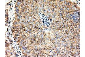 Image no. 10 for anti-Tubulin beta 4a (TUBB4A) antibody (ABIN1501580)