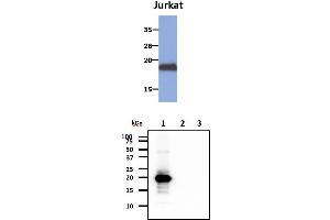 The cell lysates of Jurkat (30ug) were resolved by SDS-PAGE, transferred to PVDF membrane and probed with anti-human MAFK antibody (1:1000). (MAFK anticorps)