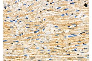 ABIN6257178 and ABIN6273623 at 1/100 staining Rat heart tissue by IHC-P. (FGF12 anticorps  (C-Term))
