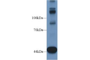 Western Blot; Sample: Mouse Heart lysate; Primary Ab: 1µg/ml Rabbit Anti-Human TNS1 Antibody Second Ab: 0. (Tensin 1 anticorps  (AA 4-307))