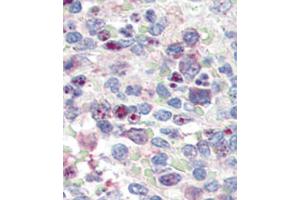 Formalin-fixed and paraffin-embedded human Spleen tissue reacted with SNAI1 antibody (N-term D24) (ABIN388809 and ABIN2850429) , which was peroxidase-conjugated to the secondary antibody, followed by AEC staining.