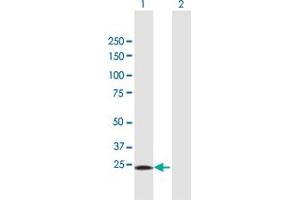 Western Blot analysis of STX1A expression in transfected 293T cell line by STX1A MaxPab polyclonal antibody.