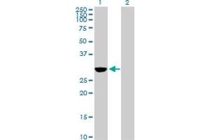 Western Blot analysis of NQO1 expression in transfected 293T cell line by NQO1 MaxPab polyclonal antibody. (NQO1 anticorps  (AA 1-274))
