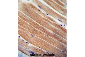 CST9 antibody (C-term) immunohistochemistry analysis in formalin fixed and paraffin embedded human skeletal muscle followed by peroxidase conjugation of the secondary antibody and DAB staining. (CST9 anticorps  (C-Term))