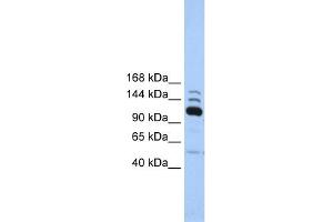 WB Suggested Anti-POLR3B Antibody Titration:  0. (POLR3B anticorps  (C-Term))