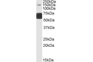 ABIN334410 (1µg/ml) staining of Human Brain (Cerebellum) lysate (35µg protein in RIPA buffer). (GRIK1 anticorps  (Internal Region))