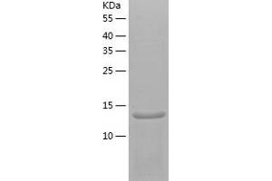 Western Blotting (WB) image for SH2 Domain Containing 1A (SH2D1A) (AA 1-128) protein (His-IF2DI Tag) (ABIN7125076)