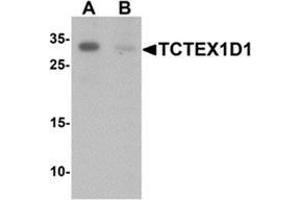 Western blot analysis of TCTEX1D1 in K562 cell lysate with TCTEX1D1 Antibody  at 1 ug/mL in (A) the absence and (B) the presence of blocking peptide. (TCTEX1D1 anticorps  (N-Term))
