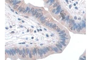 Detection of SNAP23 in Mouse Uterus Tissue using Polyclonal Antibody to Synaptosomal Associated Protein 23 kDa (SNAP23)