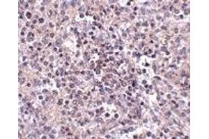 Immunohistochemistry (IHC) image for anti-Solute Carrier Family 39 (Zinc Transporter), Member 10 (SLC39A10) (Middle Region) antibody (ABIN1031175) (SLC39A10 anticorps  (Middle Region))