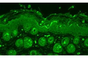Immunohistochemistry analysis using Rabbit Anti-Ubiquitin Polyclonal Antibody (ABIN361830 and ABIN361831).
