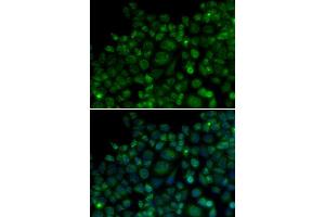 Immunofluorescence analysis of MCF7 cell using TLR7 antibody. (TLR7 anticorps  (AA 30-230))