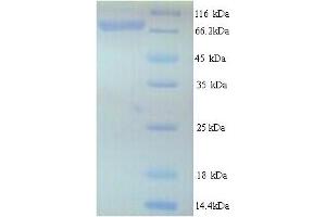SDS-PAGE (SDS) image for Ribonucleotide Reductase M1 (RRM1) (AA 1-792), (full length) protein (His tag) (ABIN5713802) (RRM1 Protein (AA 1-792, full length) (His tag))