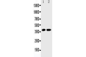 Anti-Cdk6 antibody, Western blotting Lane 1: Rat Testis Tissue Lysate Lane 2: Rat Lung Tissue Lysate (CDK6 anticorps  (C-Term))