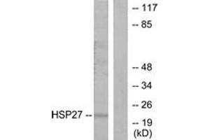 Western Blotting (WB) image for anti-Heat Shock 27kDa Protein 1 (HSPB1) (AA 5-54) antibody (ABIN2889005) (HSP27 anticorps  (AA 5-54))