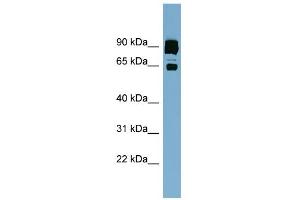 WB Suggested Anti-CLPTM1L Antibody Titration:  0.