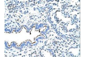 Image no. 1 for anti-Zinc Finger Protein 239 (ZNF239) (AA 160-209) antibody (ABIN6736298)