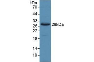Detection of Recombinant a2M, Human using Monoclonal Antibody to Alpha-2-Macroglobulin (a2M)
