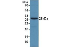 Detection of Recombinant a2M, Human using Monoclonal Antibody to Alpha-2-Macroglobulin (a2M) (alpha 2 Macroglobulin anticorps  (AA 616-856))