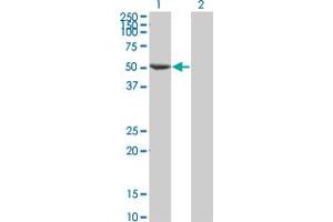 Western Blot analysis of FLI1 expression in transfected 293T cell line by FLI1 monoclonal antibody (M05), clone 1F6. (FLI1 anticorps  (AA 1-452))