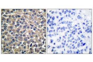 Immunohistochemistry (IHC) image for anti-Matrix Metallopeptidase 19 (MMP19) (N-Term) antibody (ABIN1848680) (MMP19 anticorps  (N-Term))