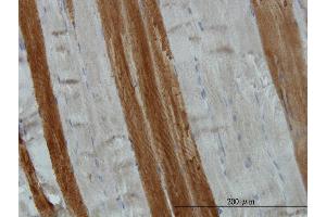 Immunoperoxidase of monoclonal antibody to TOM1 on formalin-fixed paraffin-embedded human skeletal muscle.