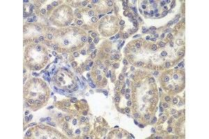 Immunohistochemistry of paraffin-embedded Rat kidney using H6PD Polyclonal Antibody at dilution of 1:200 (40x lens). (Glucose-6-Phosphate Dehydrogenase anticorps)